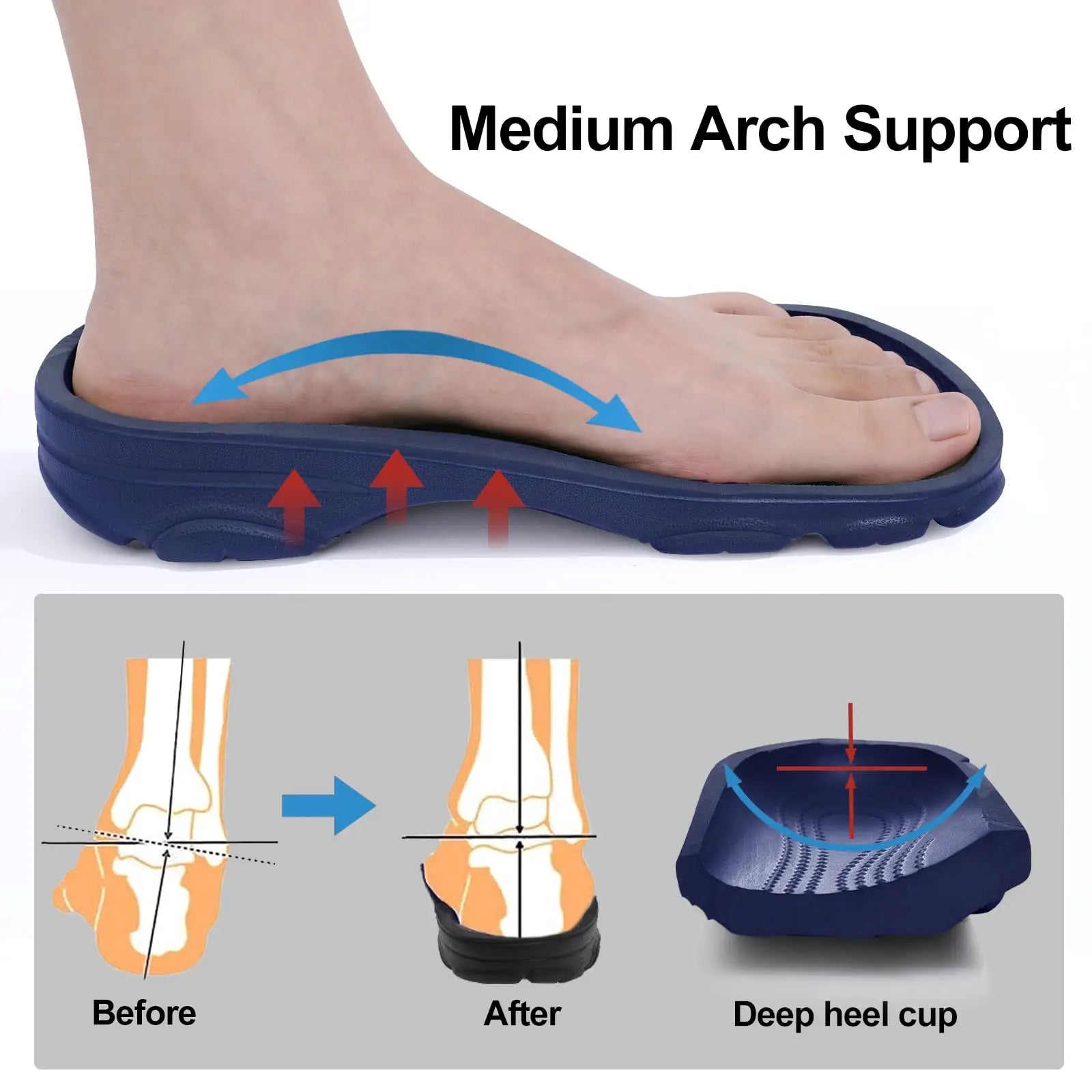 Comwarm Arch Support Sandals For Men Classic Clogs Slippers Adjustable Garden Clogs Breathable Cozy Home Shoes Men Clogs Sandals
